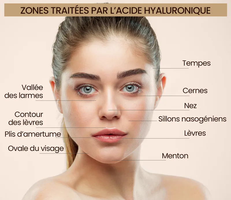 Comblement acide hyaluronique Sousse Tunisie