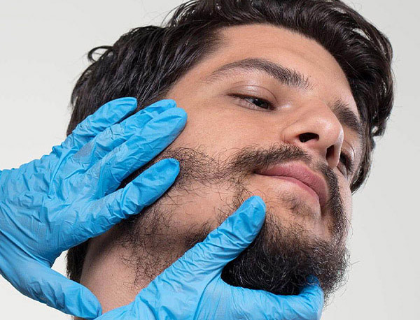 Greffe de barbe Tunisie