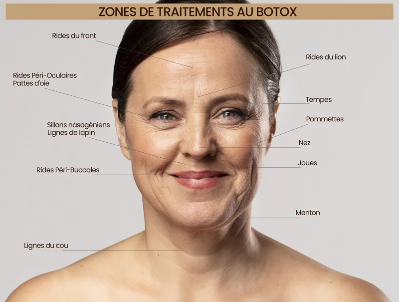 Botox Sousse Tunisie
